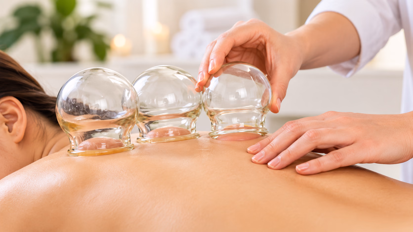 A practitioner placing glass cupping cups along a client's back